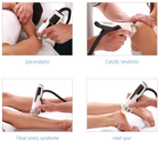Ondas de Choque Clínicas Intelect® Focus Chattanooga